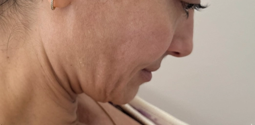 bg-01-before-brazilian