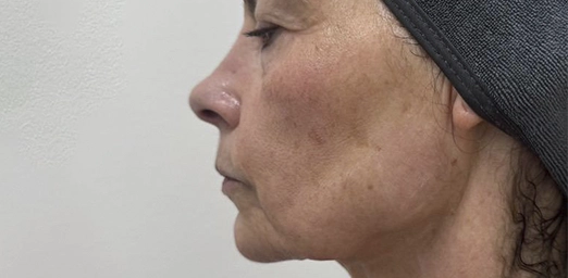 bg-02-before-brazilian