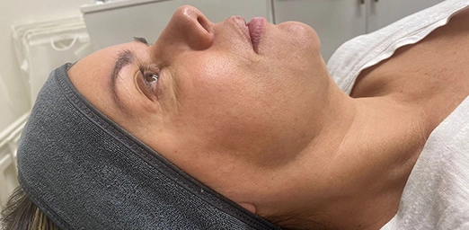 bg-02-facialdrainage-before-brazilian bg-02-facialdrainage-before-brazilian